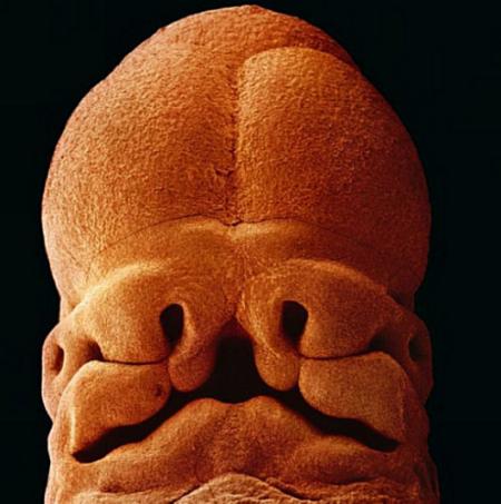 5周大的胎儿。此时的胎儿只有大约9毫米长。面部正在发育，嘴巴、鼻孔和眼睛正在形成。