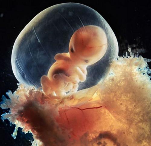 胎儿子宫内发育的震撼照
