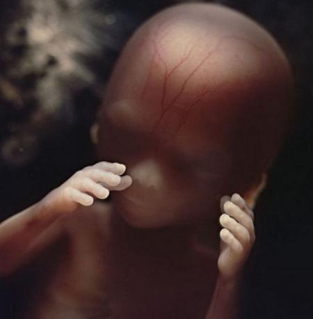 16周大的胎儿。小家伙用手探索自己的身体以及周围的环境。