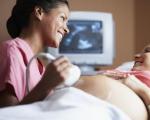 孕期排畸检查