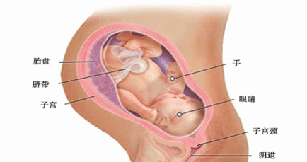 腹腔妊娠的原因