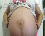 孕妇4个月双胞胎,250斤孕妈妈怀双胞胎7个月竟然不知道