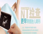 nt检查正常值,NT检查是什么？多少值算正常？