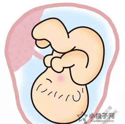 胎儿脐带绕颈怎么办    