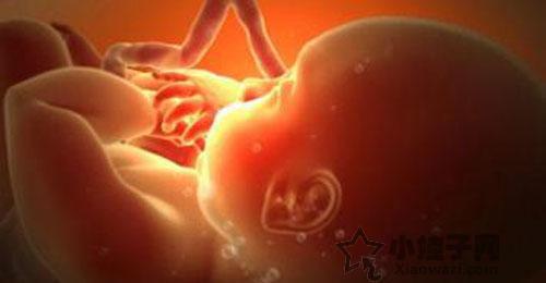 孕妈妈羊水过多怎么办?